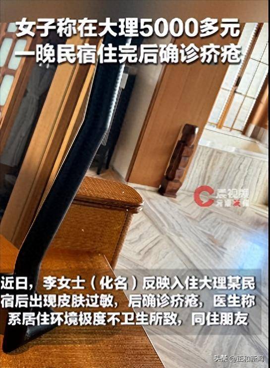 皇冠体育App下载_女子称在大理住5000多元一晚的民宿后过敏一个月确诊疥疮皇冠体育App下载,沟通维权却被回复“如果需要不投诉以及不发帖,要给多少钱”,目前民宿拒绝采访