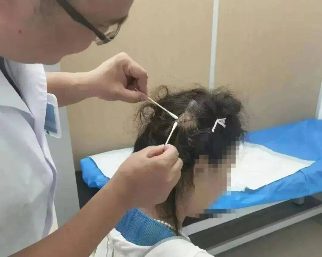 皇冠信用网在线开户_杭州一女子开车等红灯被追尾皇冠信用网在线开户，后脑勺鲨鱼夹撞稀碎